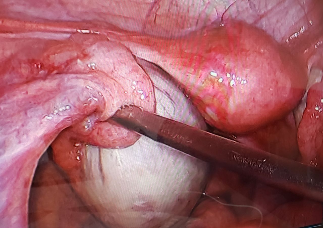 Germán Gabriel Palacios López-28