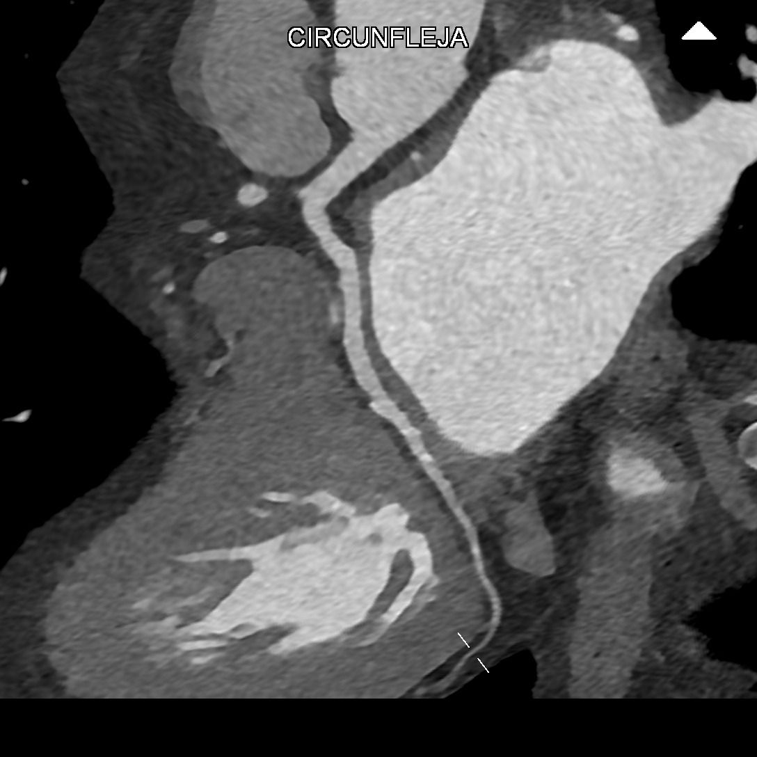 Miguel Franco Estrada-3