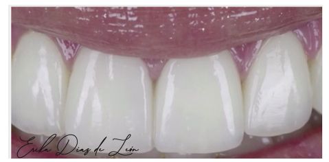 Erika Díaz De León Torres-12