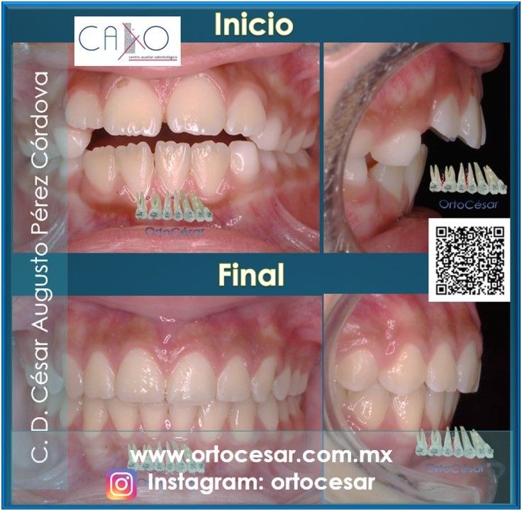 César Augusto Pérez Córdova-23