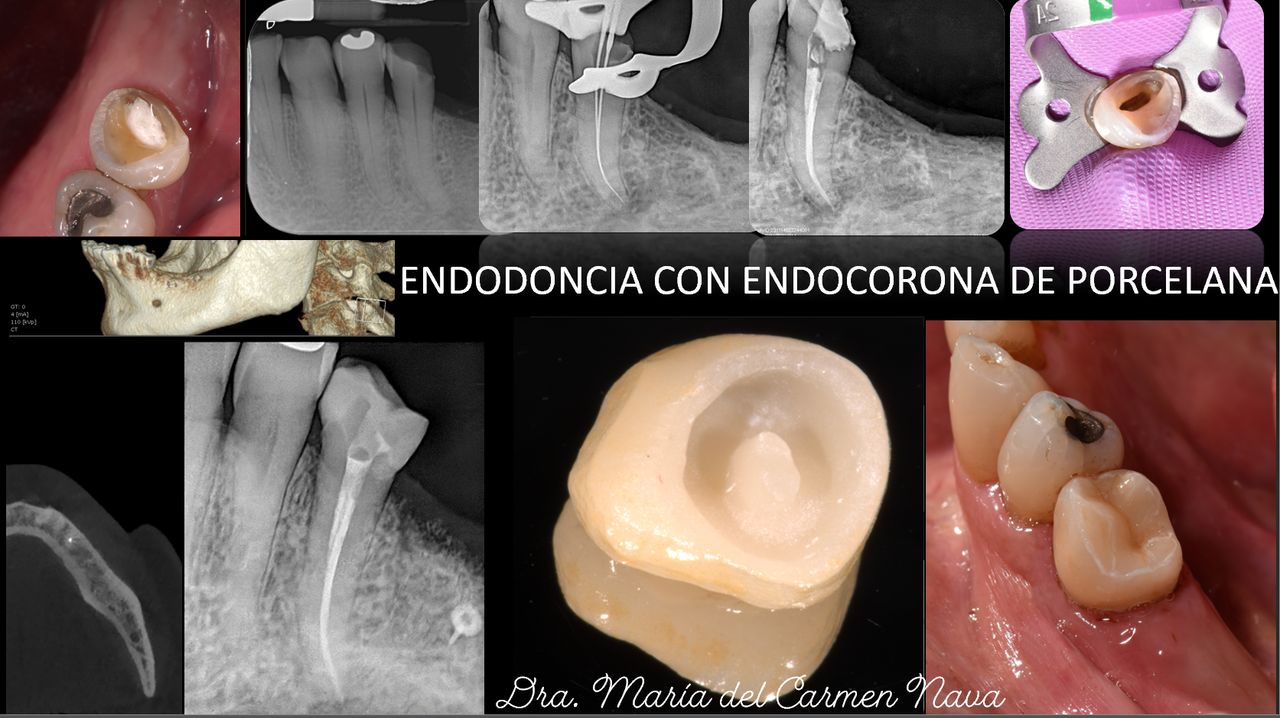 María Del Carmen Nava Jiménez-5