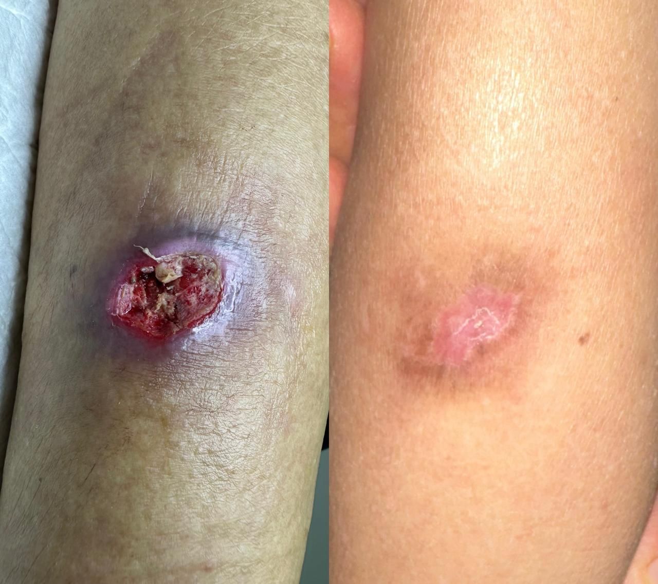 Jhonatan López González-38