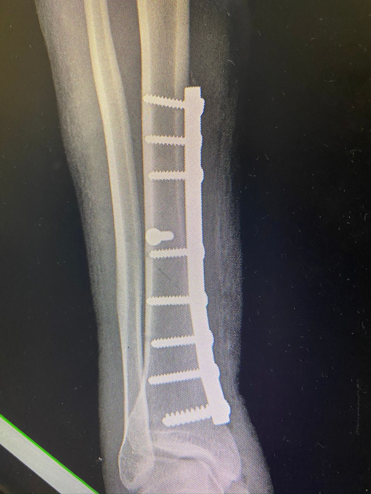 Alberto Lorenzo Cortés-14