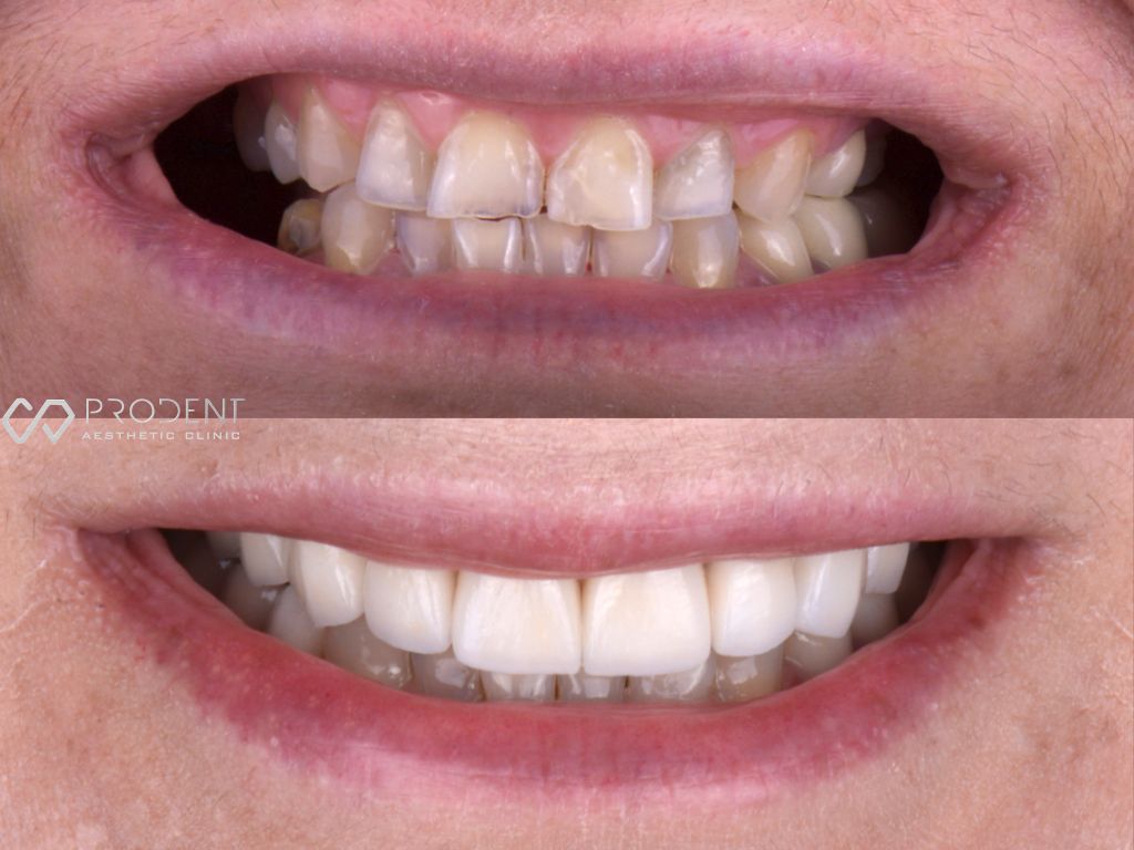 Ulises Pérez Murillo-68