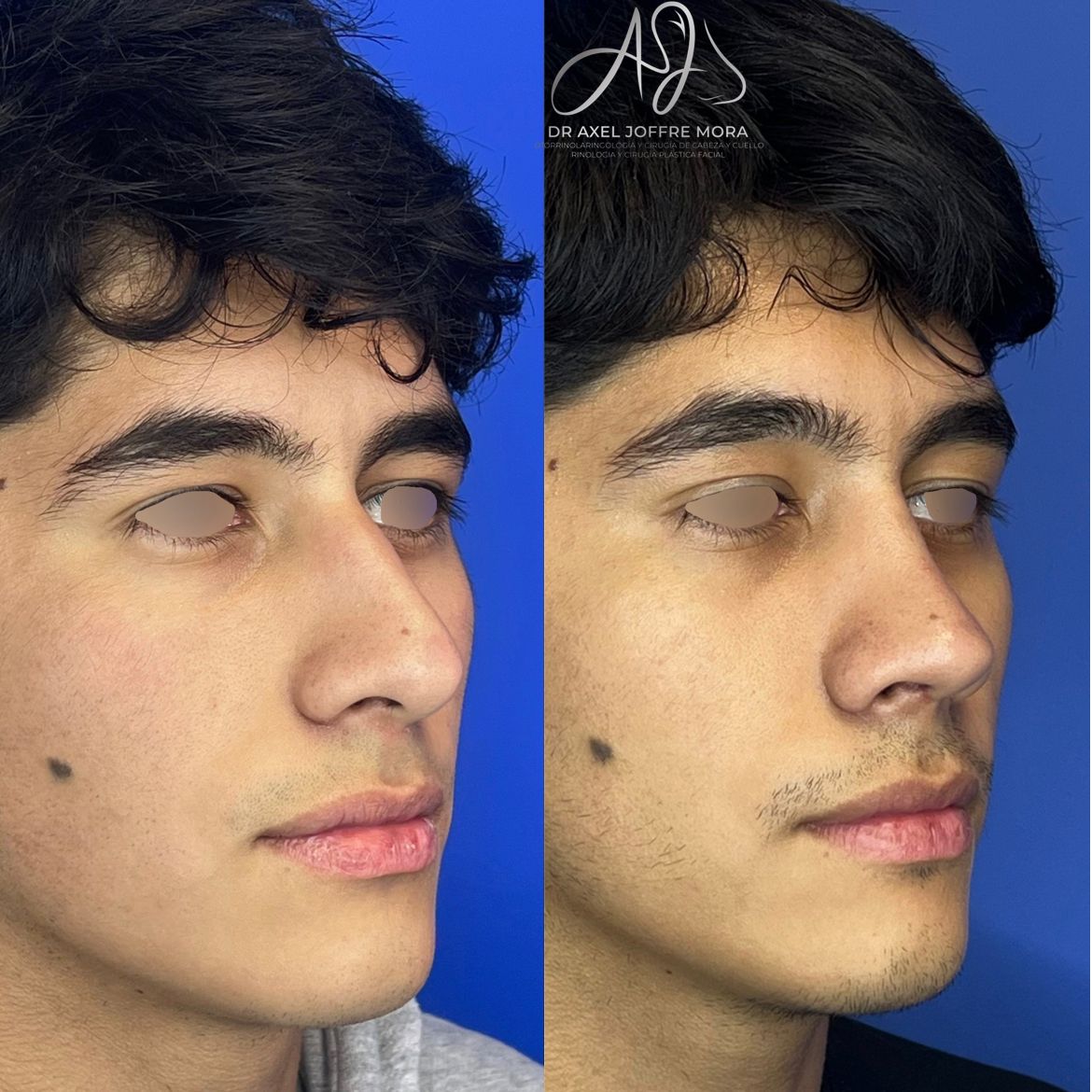 Axel Joffre Mora-60
