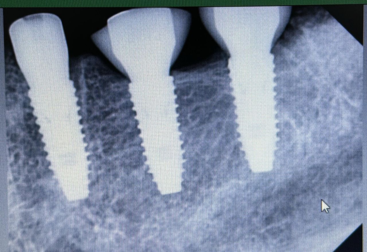 Luis Angel Carranza Resendez-8