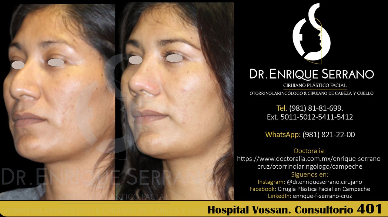 Enrique Serrano Cruz-89