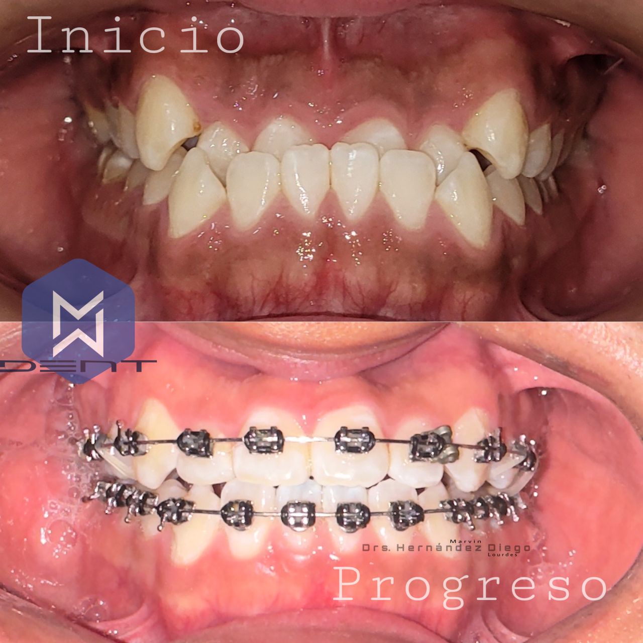 Marvin Adair Hernández Álvarez-19