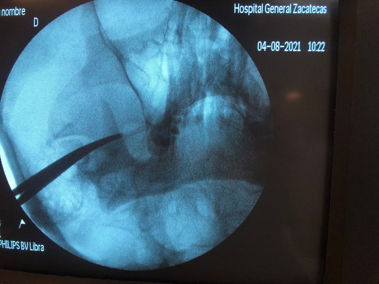 Liber Abdel Arenas Garcia-0