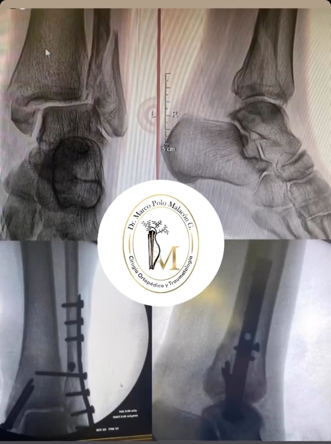 Marco Polo Malacón Gutiérrez-22