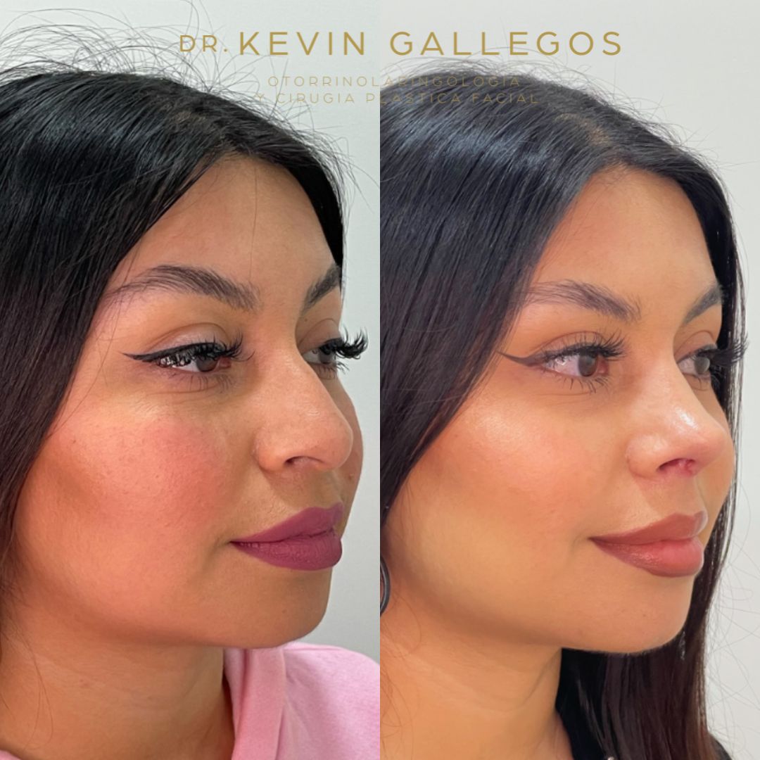 Kevin Iram Gallegos Montero-0