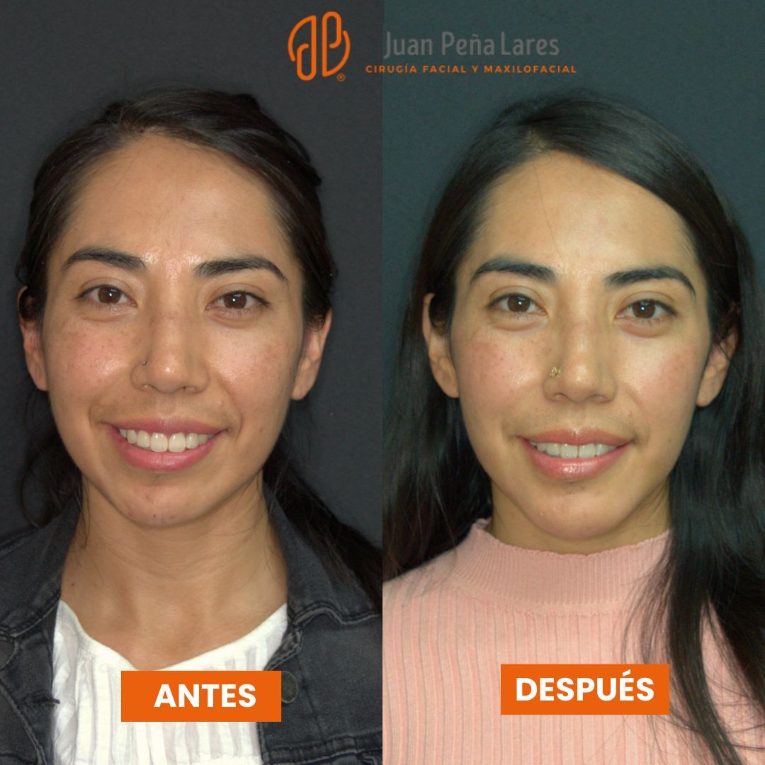 Juan Peña Lares-5