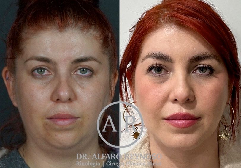 Jose Alberto Alfaro Reynoso-8