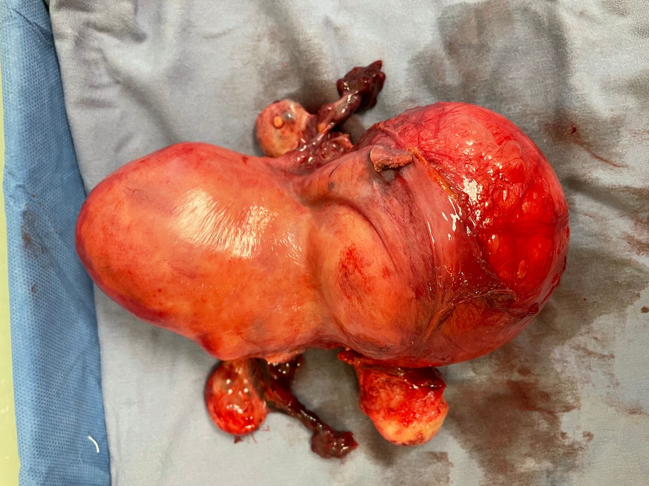 Gonzalo Hernández Martínez-48