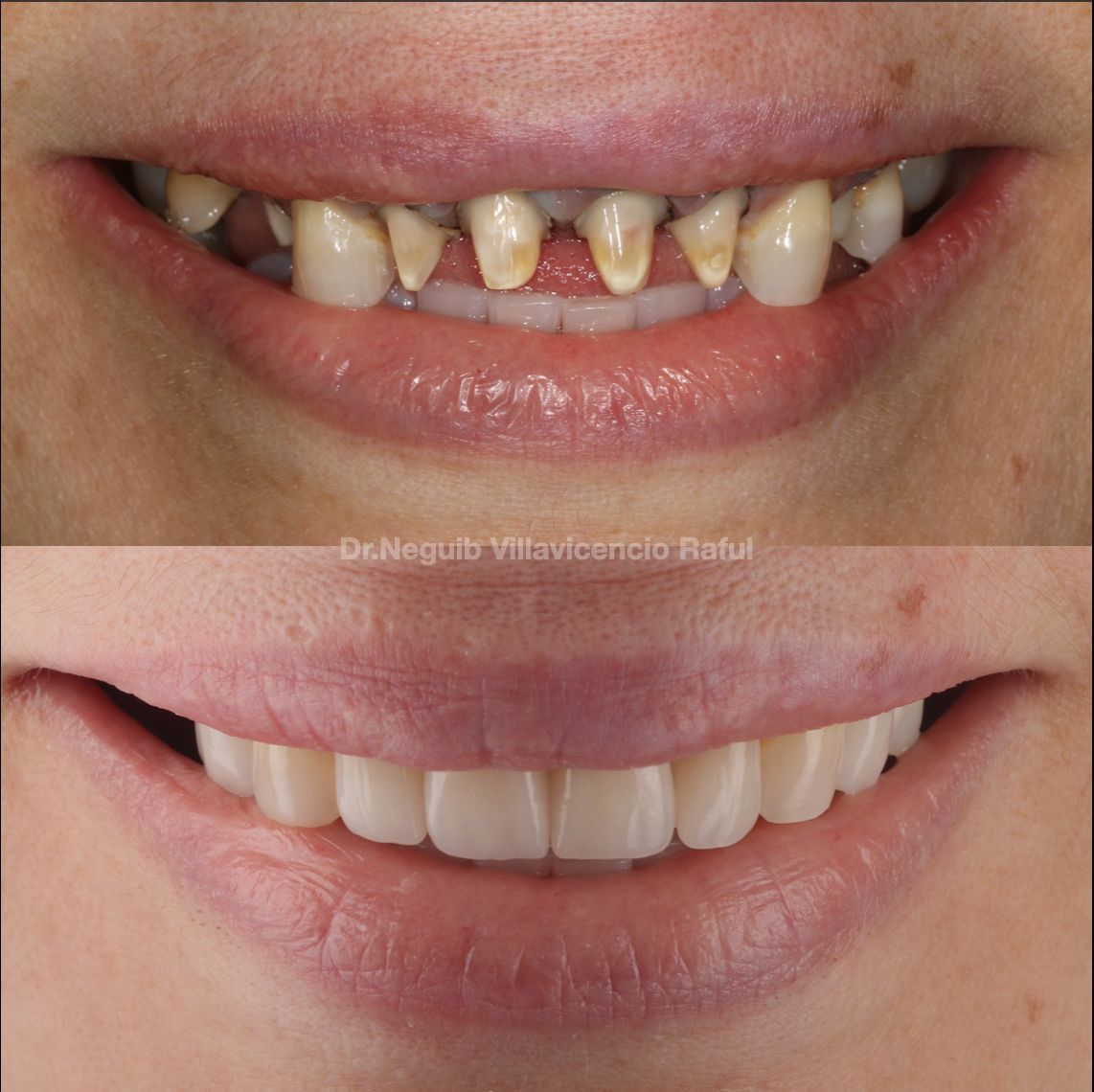 Neguib Villavicencio Raful-27