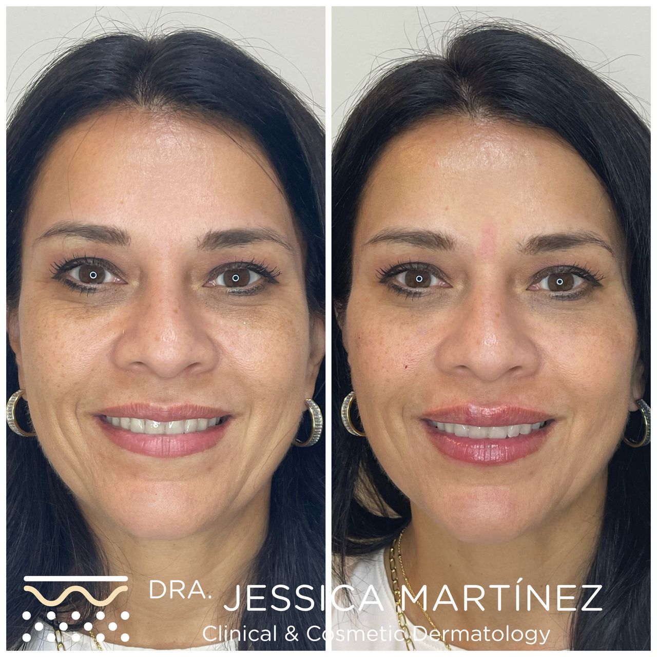 Jessica Martínez-1