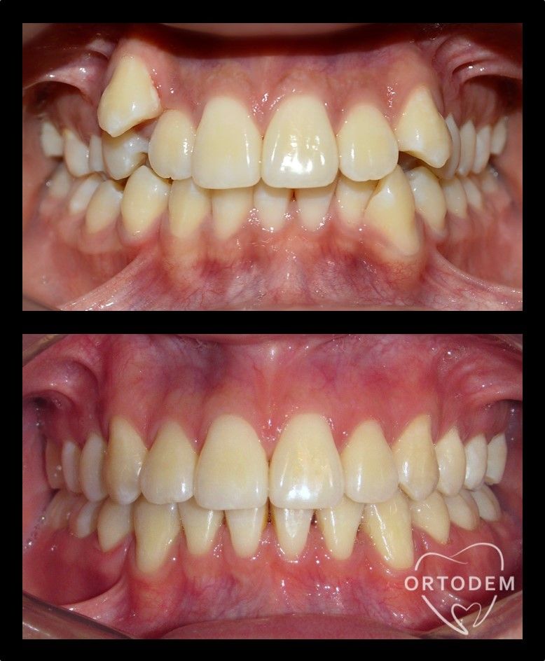 Elizabeth Morelos Morales-14