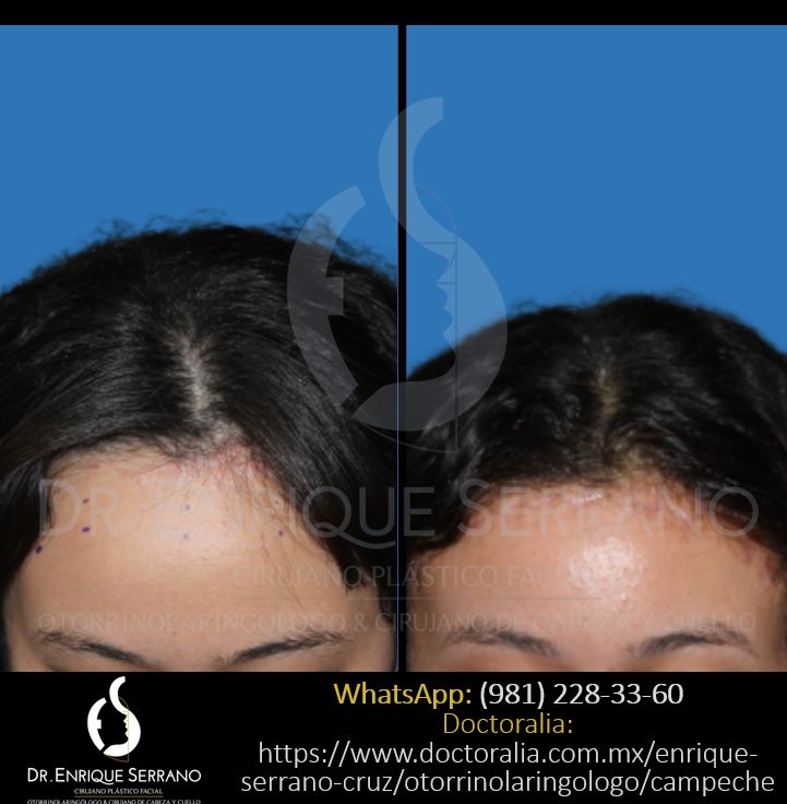 Enrique Serrano Cruz-41