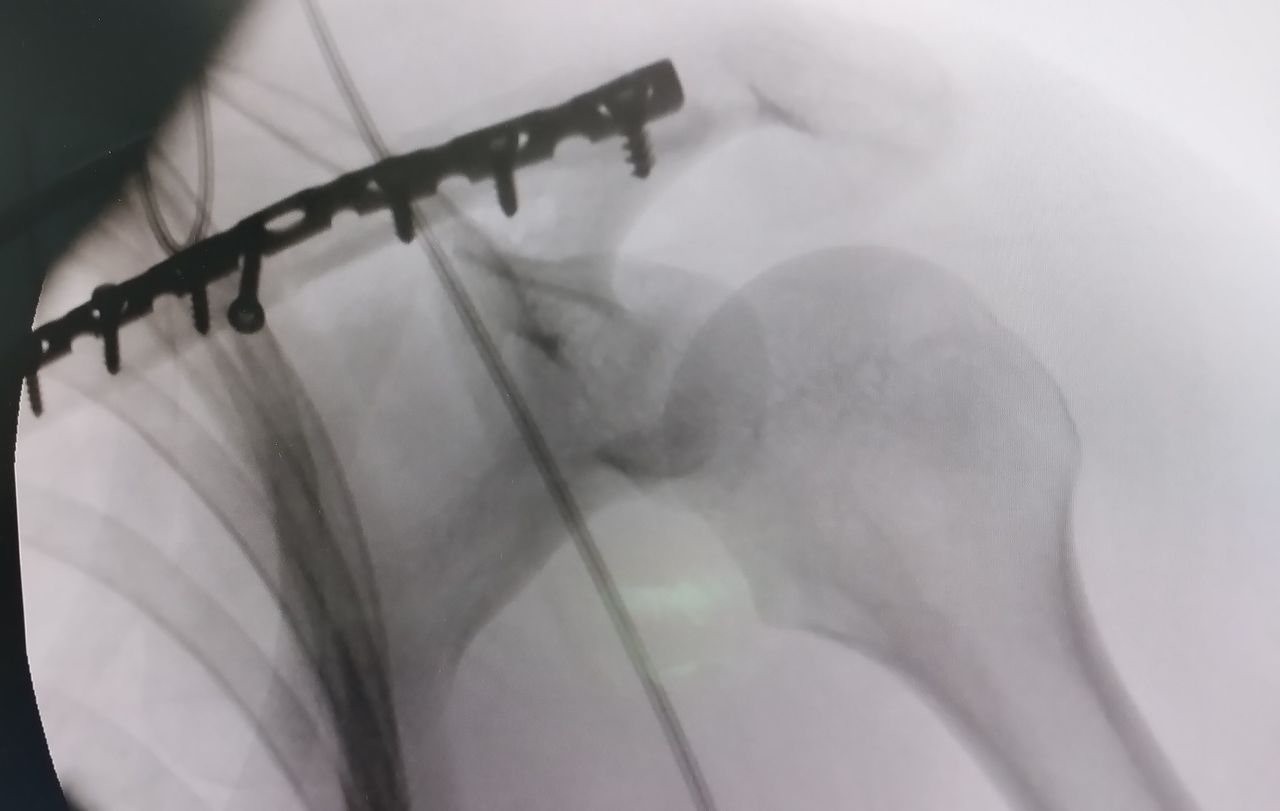 Leonardo Isaac Re-11