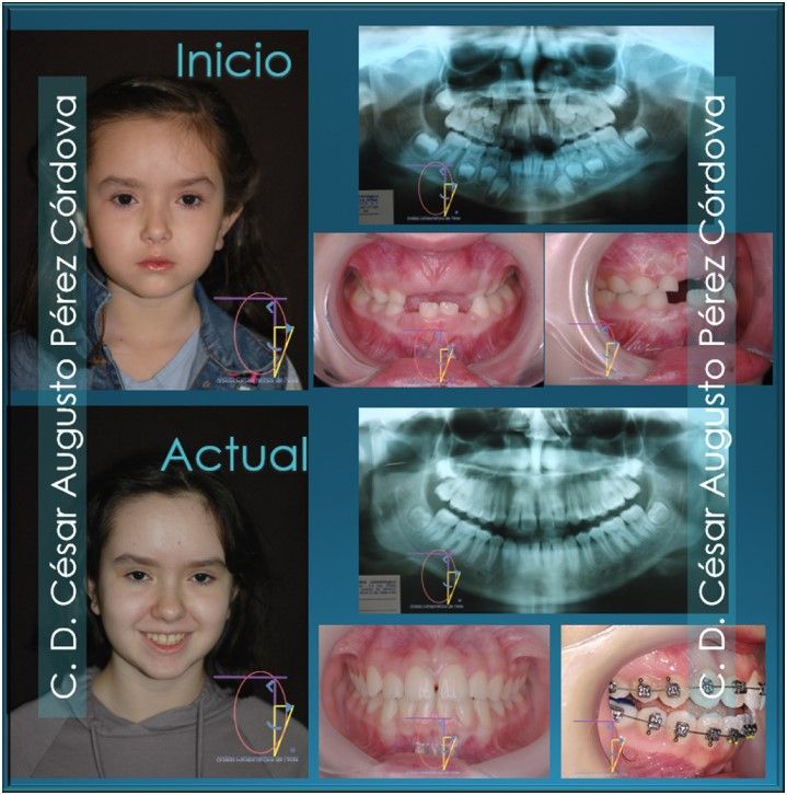César Augusto Pérez Córdova-38