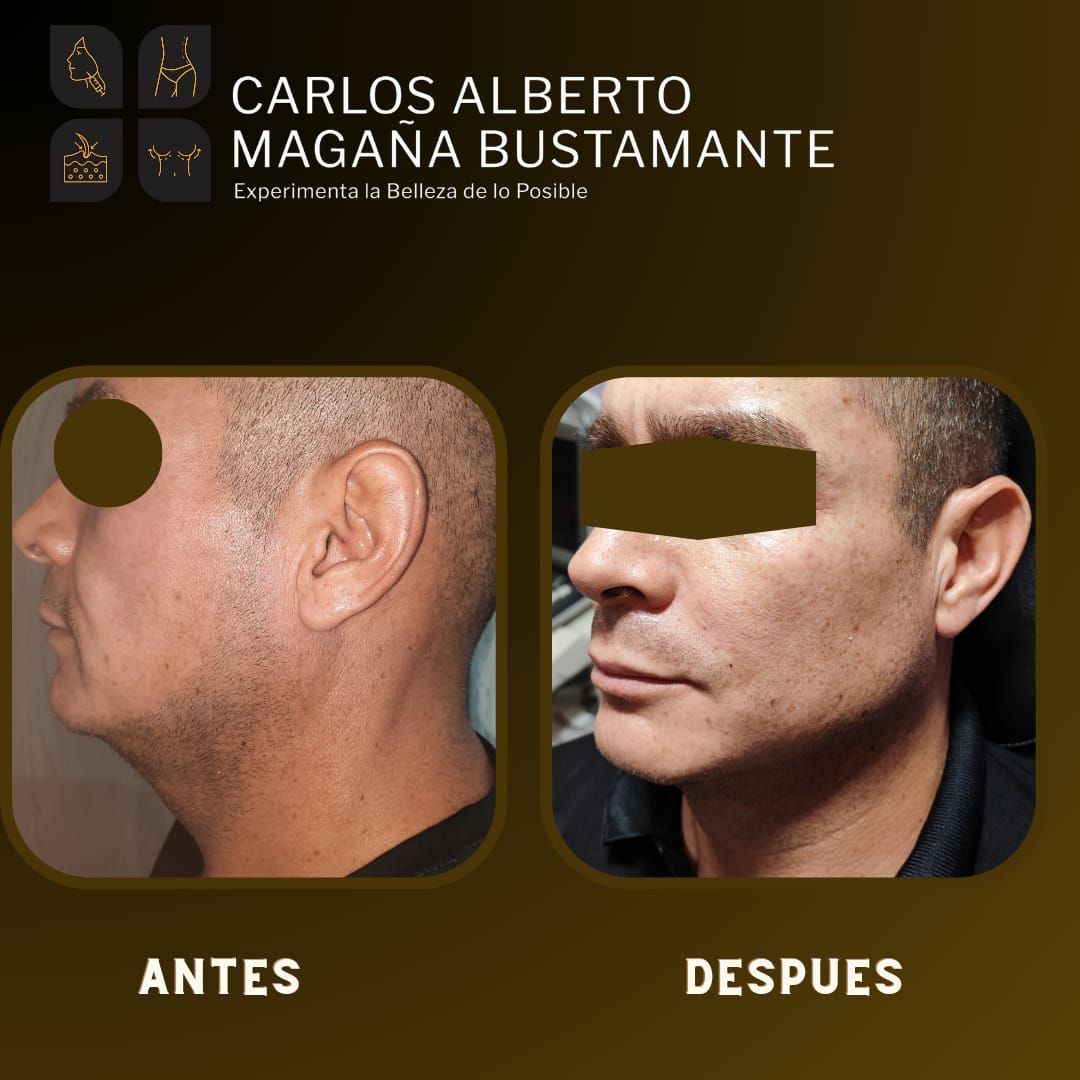 Carlos Alberto Magaña Bustamante-7