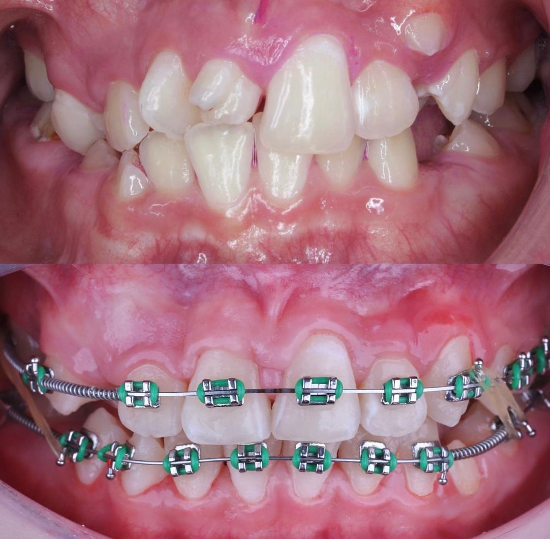 Yoana Lopez Garcia-3