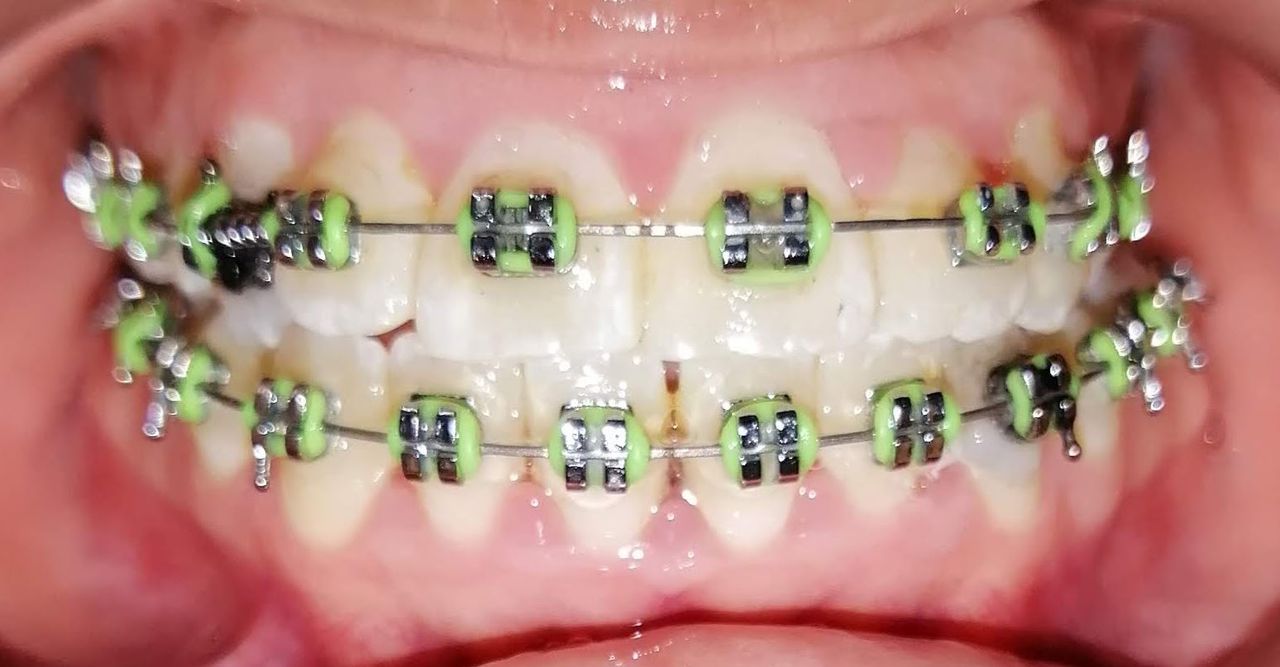 Yaneth Gutiérrez Sánchez-35