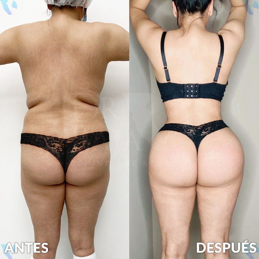 Renato Rodríguez Hirales-10