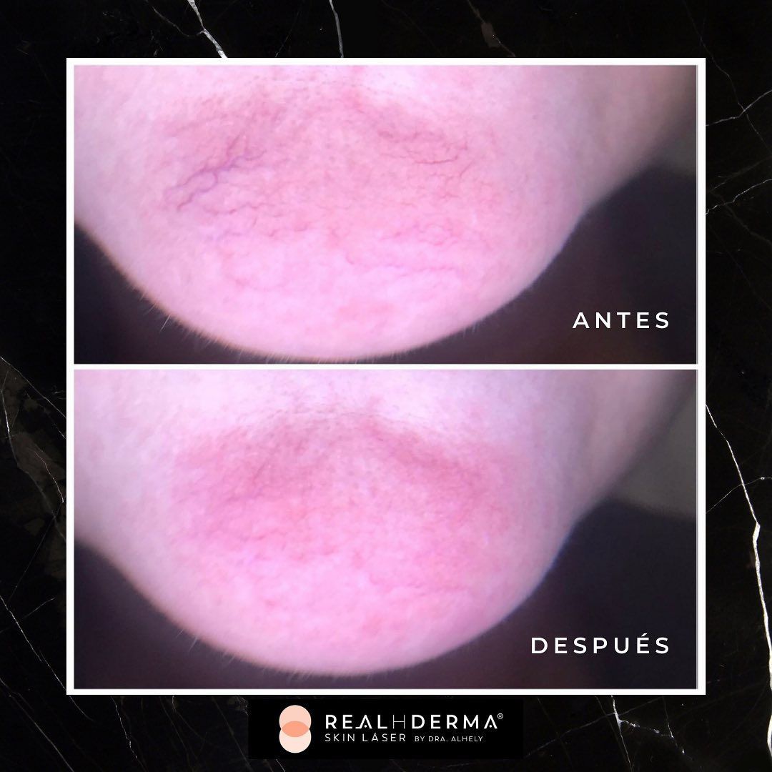 Laura Alheli Niebla Maldonado-16