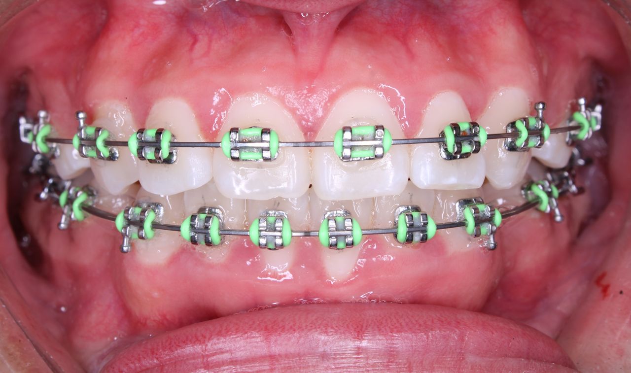 Citlalli Escamilla Martínez-3
