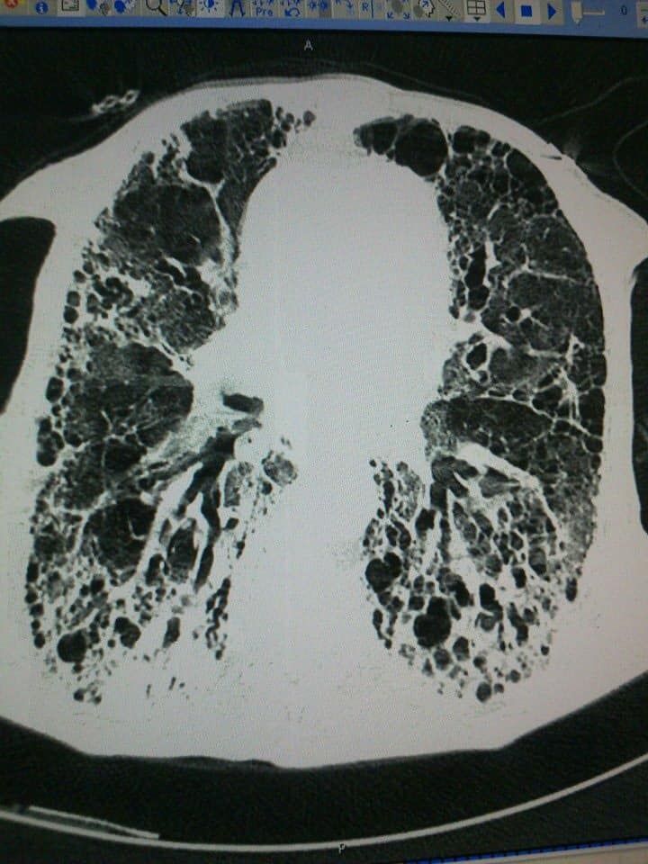 Alejandro Marin Castañeda Baron-7