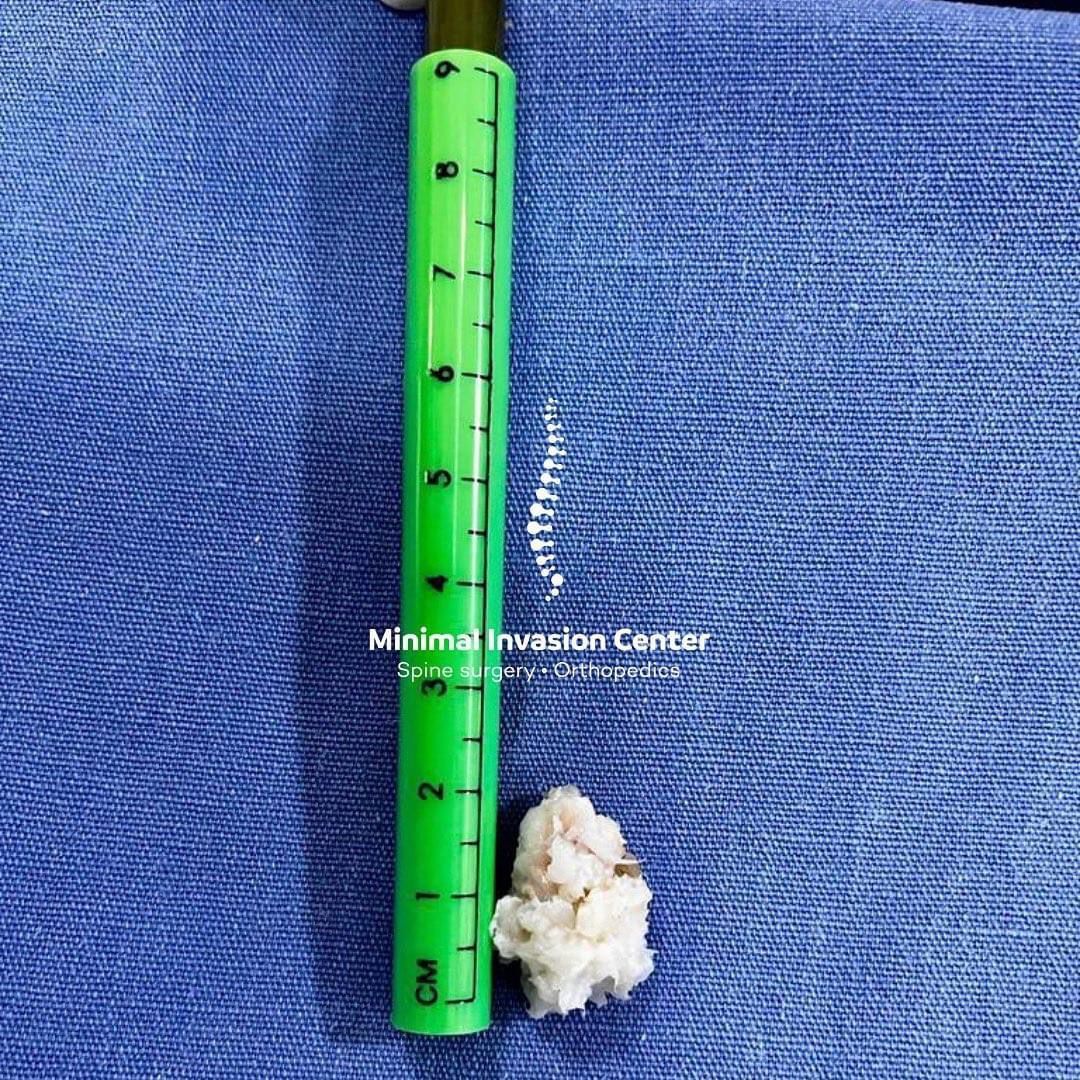 Omar Marroquín Herrera-28