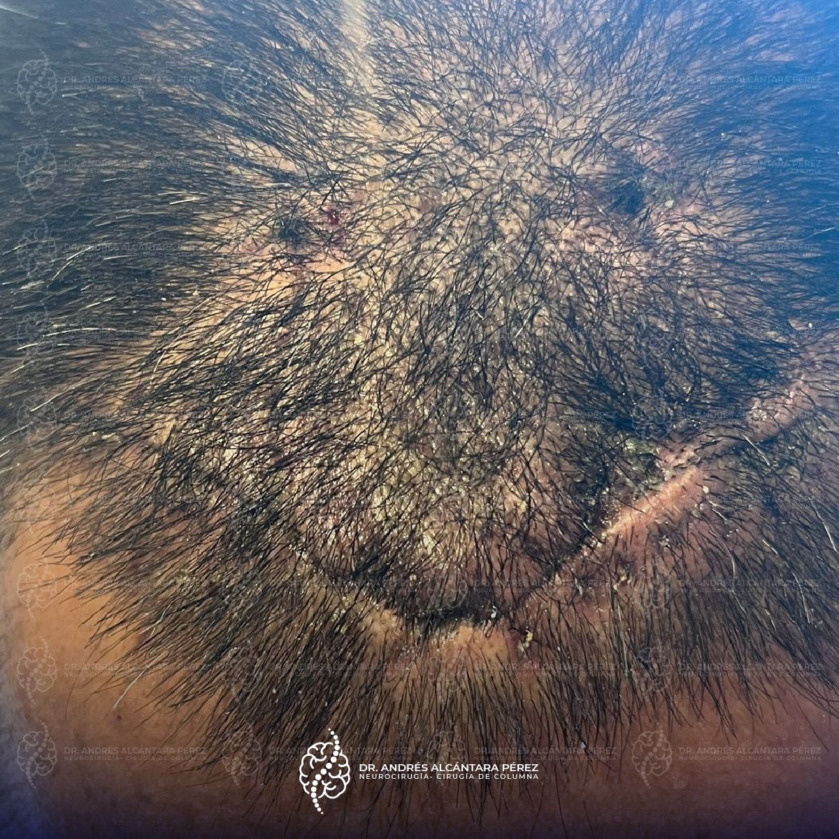 Andres Alcántara Pérez-1