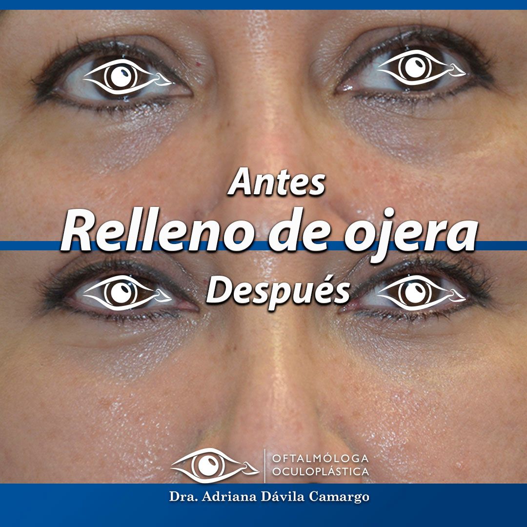 Adriana Davila Camargo-12