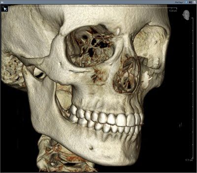 José Sayavedra Jaimes-10