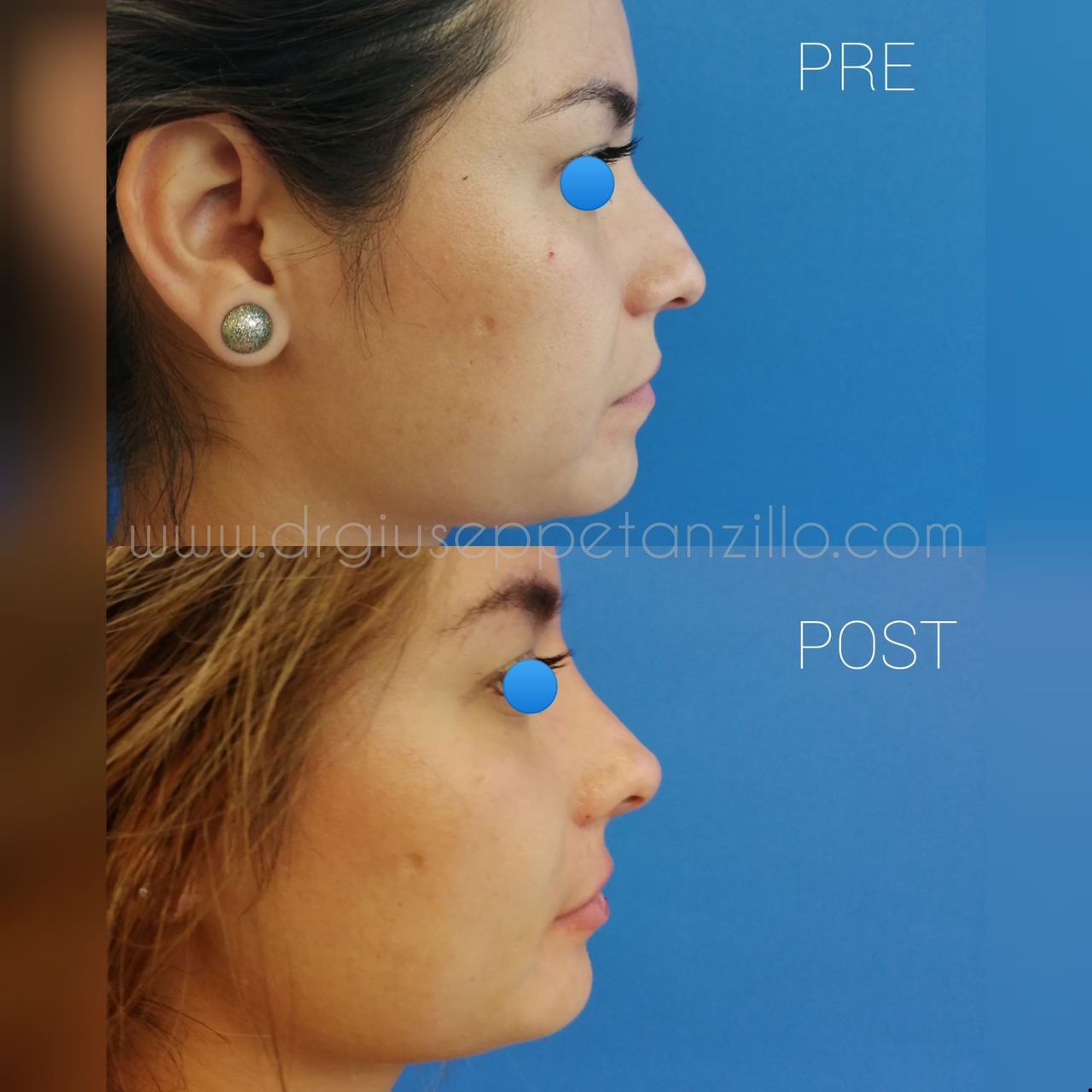 Giuseppe Tanzillo-76