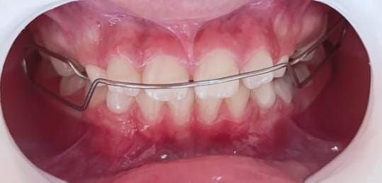 Cinthya Atzidy Feria Garay-21