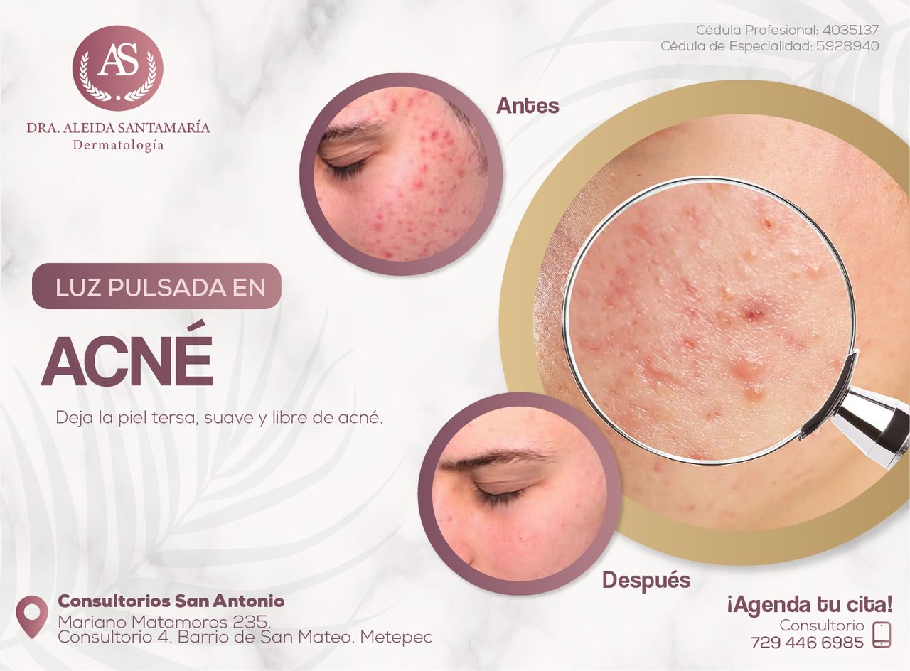 Aleida Santamaria Roman-2