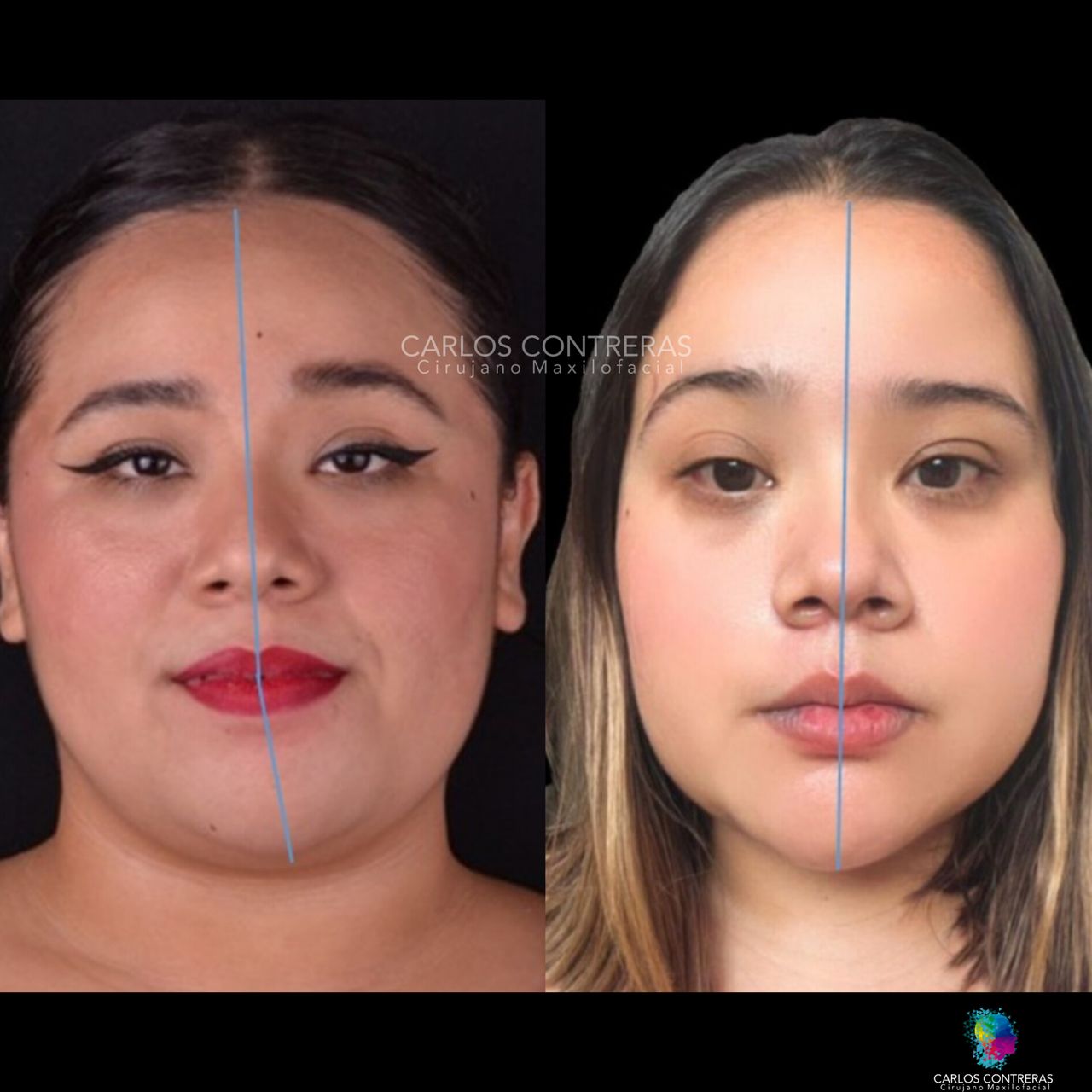 Carlos Ernesto Contreras Castellanos-33