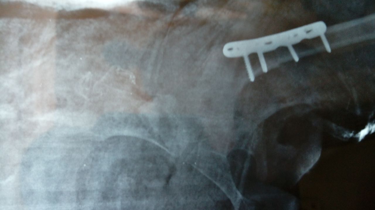 Valerio Licerio De La Cruz-5