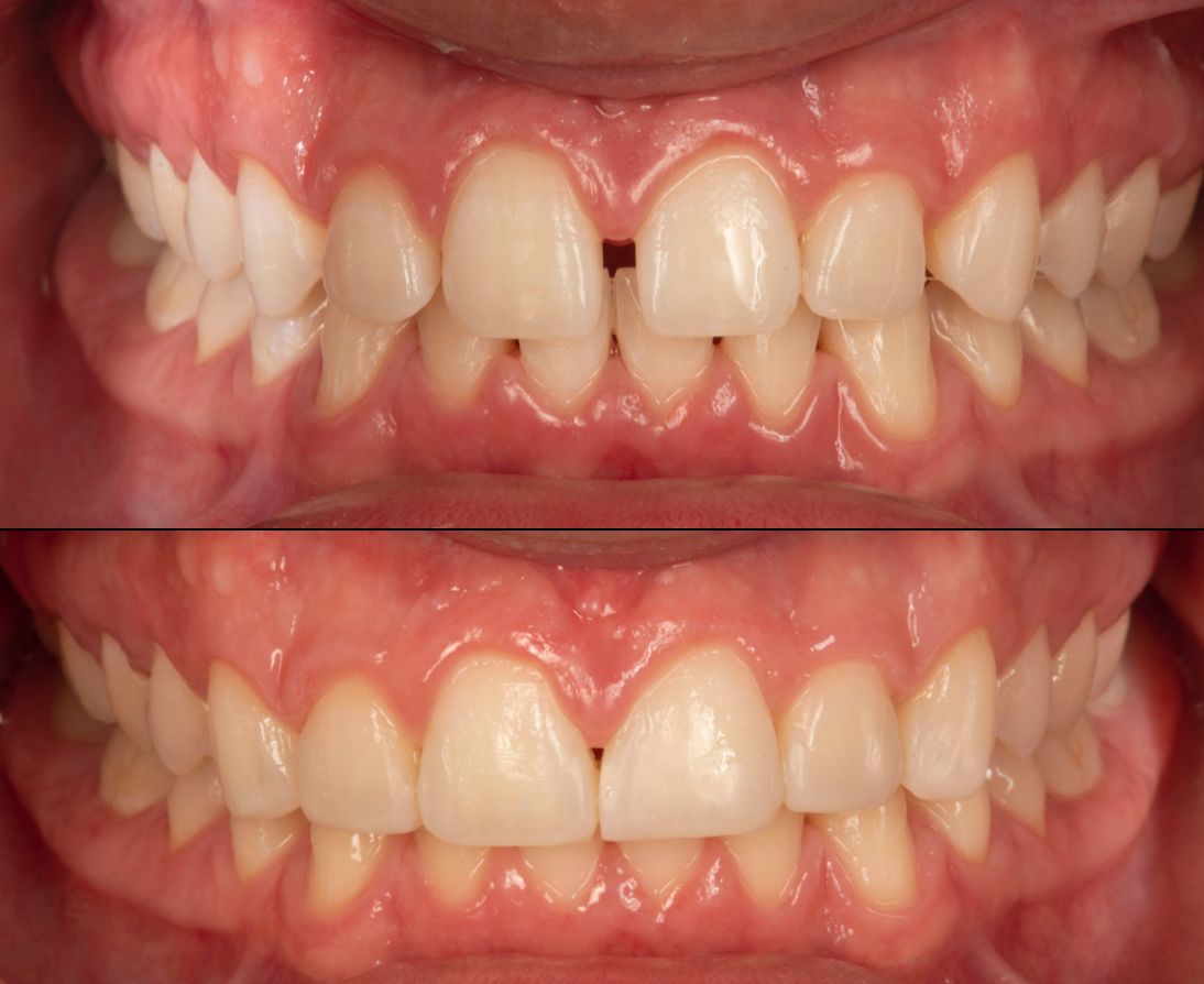 María Fernanda González Gastelum-34