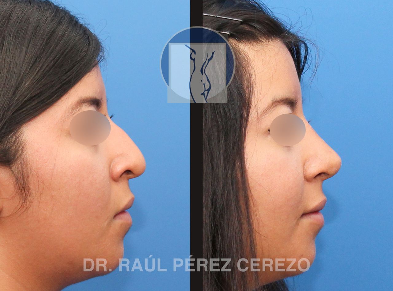 Raúl Pérez Cerezo-3