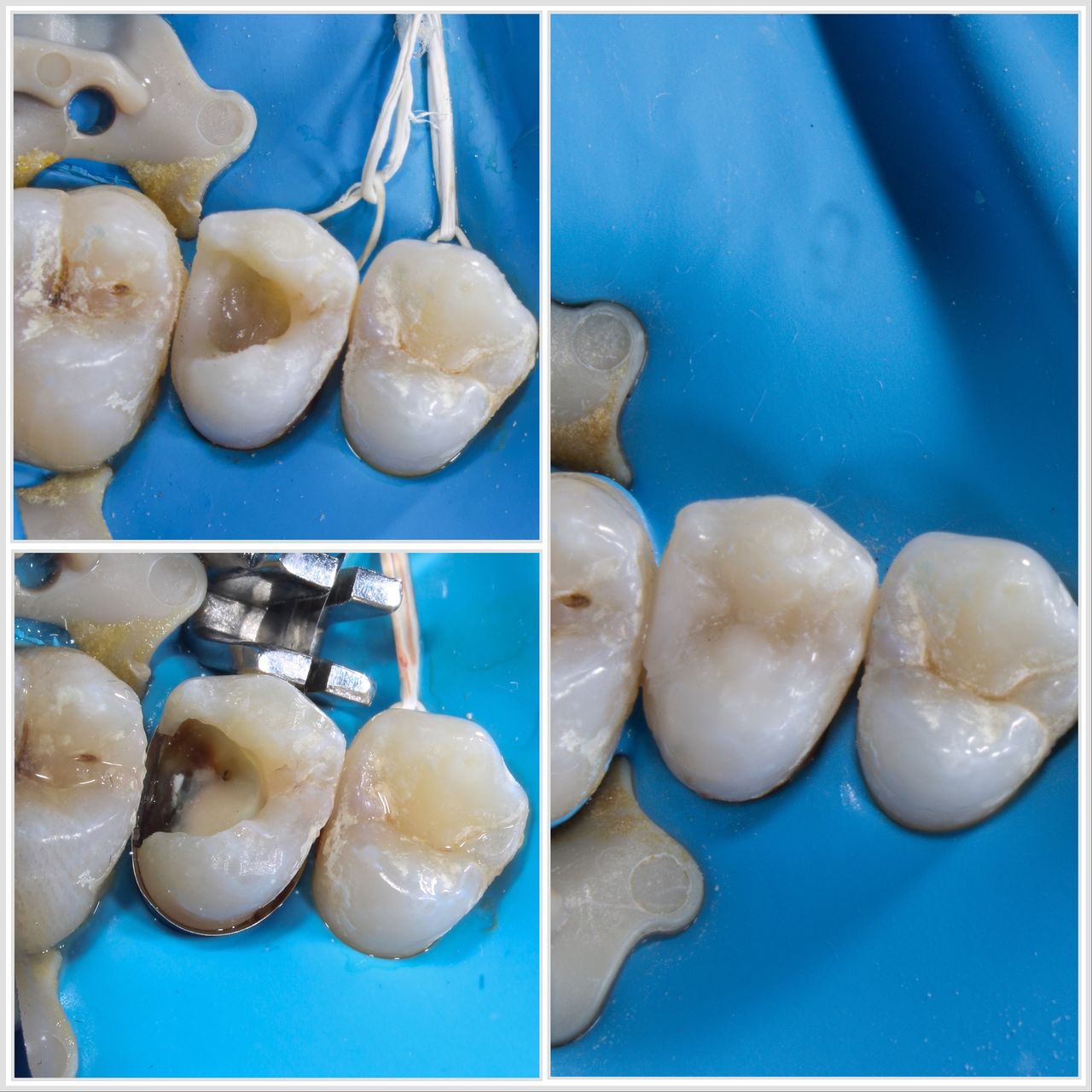 Hervin Eduardo Mendez Borrego-19