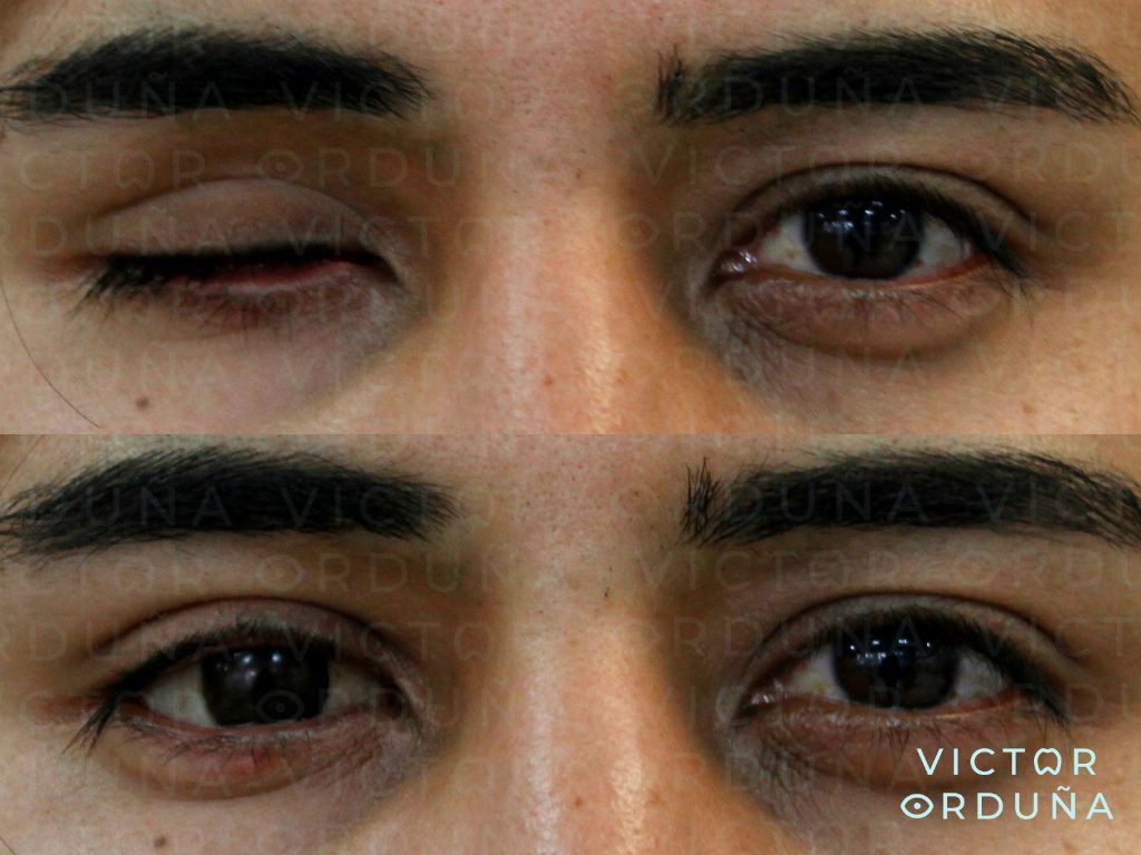 Víctor Felipe Orduña López-3