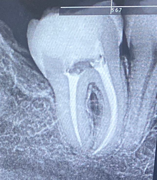 Teresita Lechuga Salazar-0