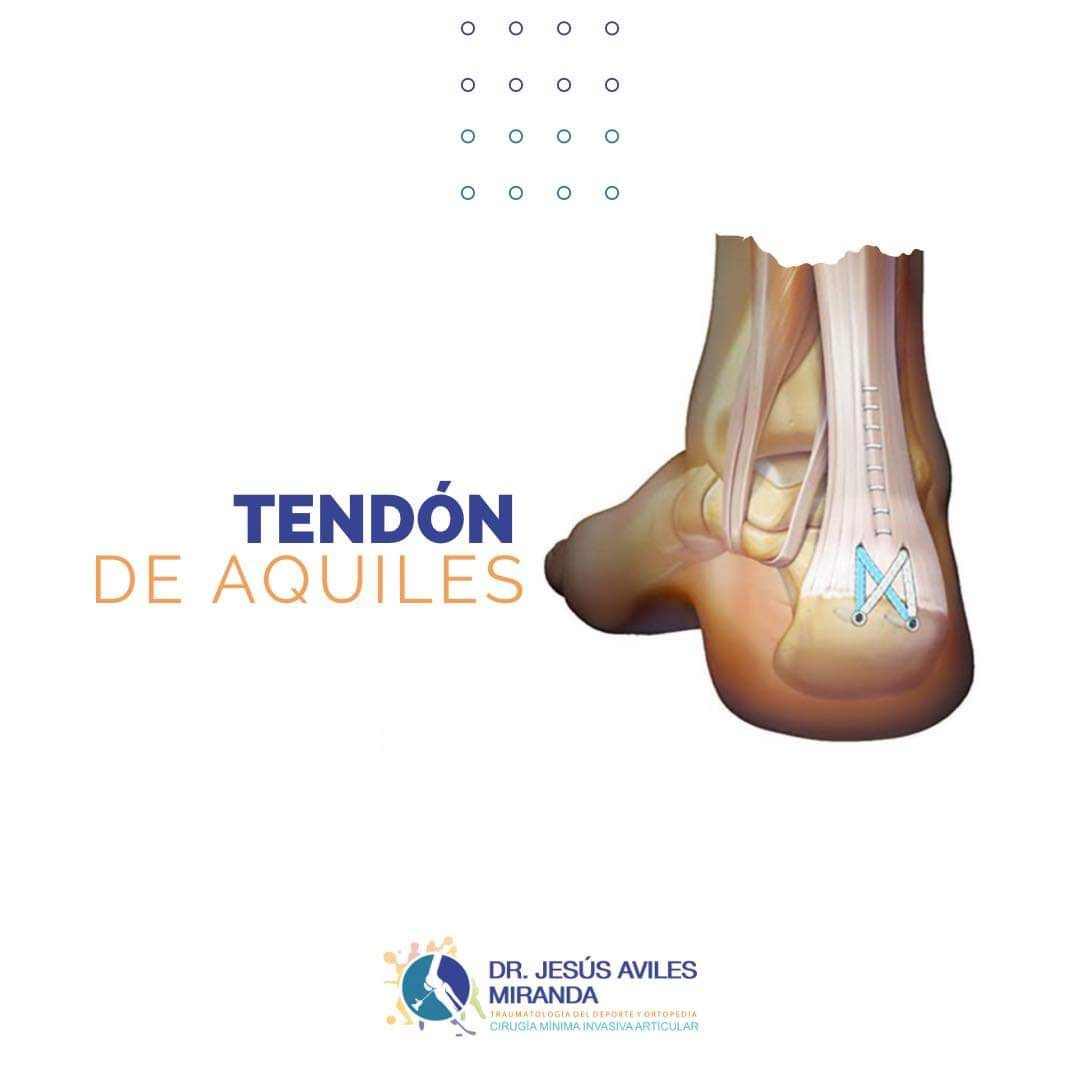 Jesús Aviles Miranda-5