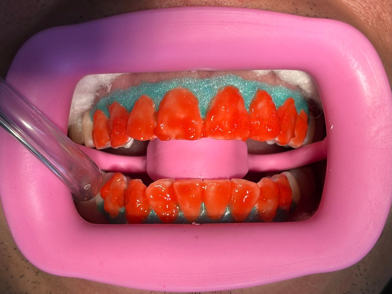 María Paula  Flores Novoa-55