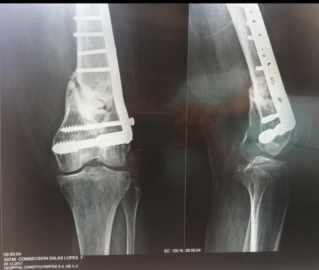 Gerardo Bautista Díaz-6