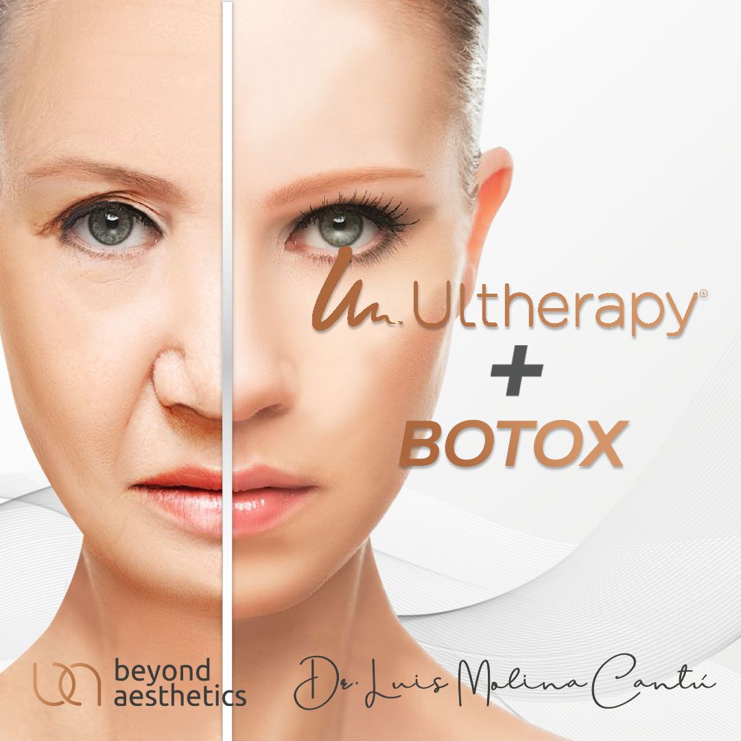 Luis Molina Cantú-8