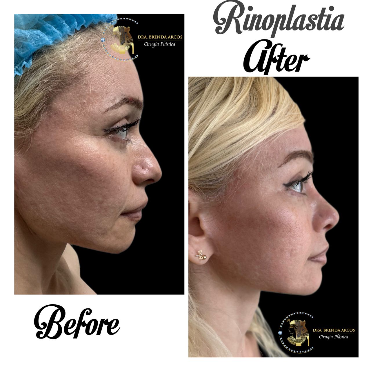 Brenda Arcos Vera-11